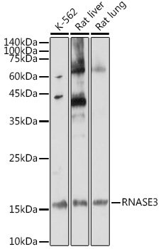 RNASE3 Rabbit pAb