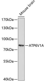 ATP6V1A Rabbit pAb