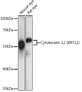Cytokeratin 12 (KRT12) Rabbit pAb