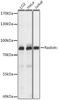 Radixin Rabbit pAb