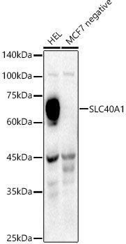 SLC40A1 Rabbit pAb