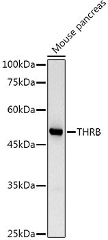 TRβ1/THRB Rabbit pAb