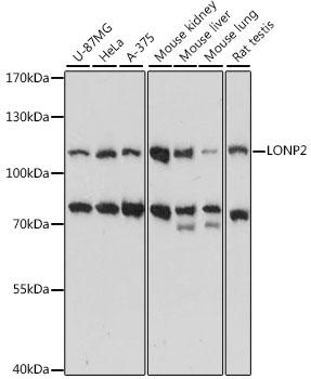 LONP2 Rabbit pAb