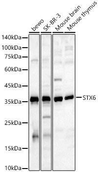 STX6 Rabbit pAb