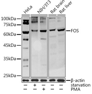 FOS Rabbit pAb