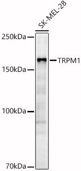 TRPM1 Rabbit pAb