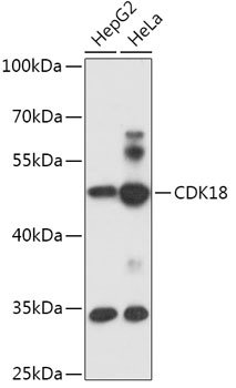 CDK18 Rabbit pAb
