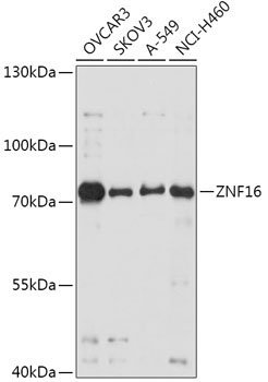 ZNF16 Rabbit pAb