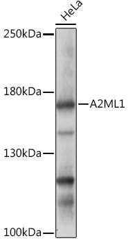 A2ML1 Rabbit pAb
