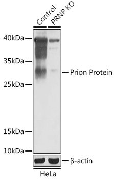 [KO Validated] Prion Protein Rabbit pAb