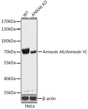 [KO Validated] Annexin A6/Annexin VI Rabbit pAb