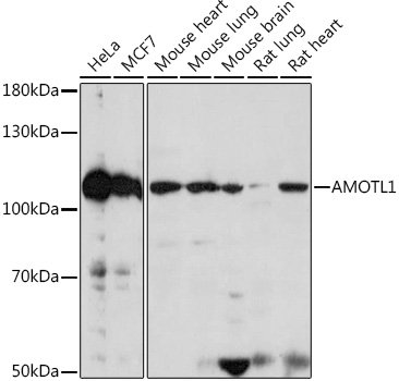 AMOTL1 Rabbit pAb
