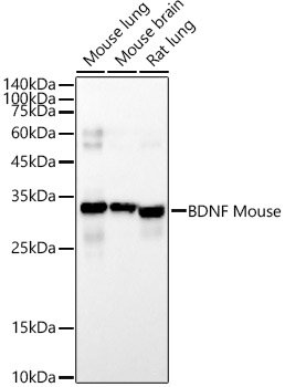 BDNF Mouse mAb