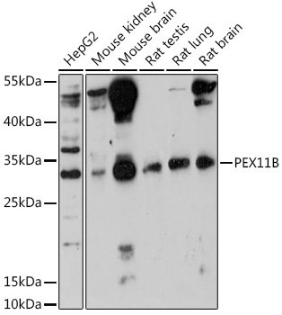 PEX11B Rabbit pAb