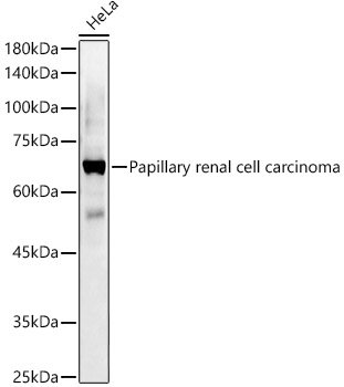 Papillary renal cell carcinoma Rabbit pAb