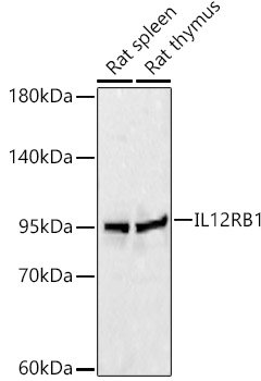 IL12RB1 Rabbit pAb