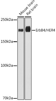 ErbB4/HER4 Rabbit mAb