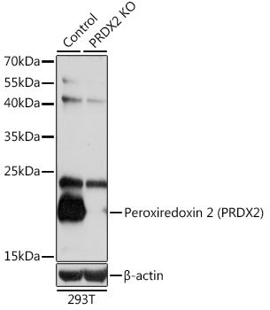 [KO Validated] Peroxiredoxin 2 (PRDX2) Rabbit pAb