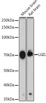 LGI1 Rabbit mAb