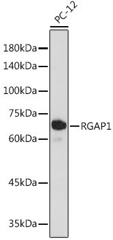 RGAP1 Rabbit mAb