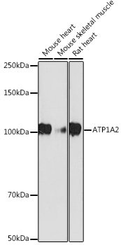 ATP1A2 Rabbit mAb