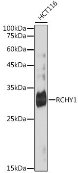 RCHY1 Rabbit mAb