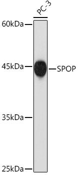 SPOP Rabbit mAb