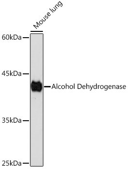 Alcohol Dehydrogenase Rabbit mAb