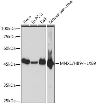 MNX1/HB9/HLXB9 Rabbit mAb