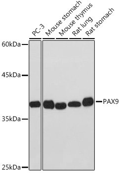 PAX9 Rabbit mAb