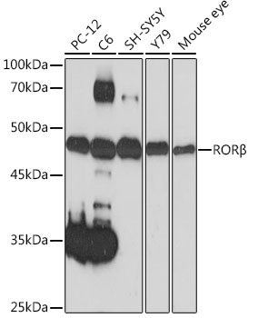 RORβ Rabbit mAb