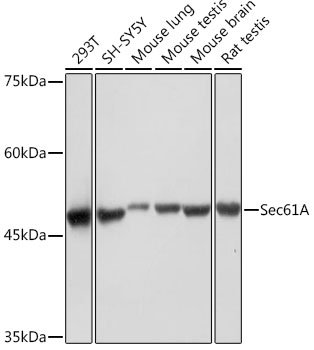 Sec61A Rabbit mAb
