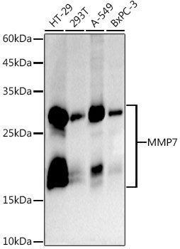 MMP7 Rabbit mAb