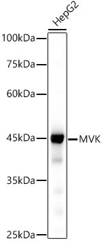 MVK Rabbit mAb