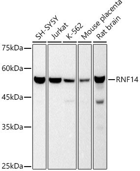 RNF14 Rabbit mAb