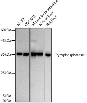 Pyrophosphatase 1 Rabbit mAb