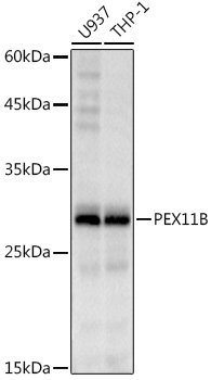 PEX11B Rabbit mAb
