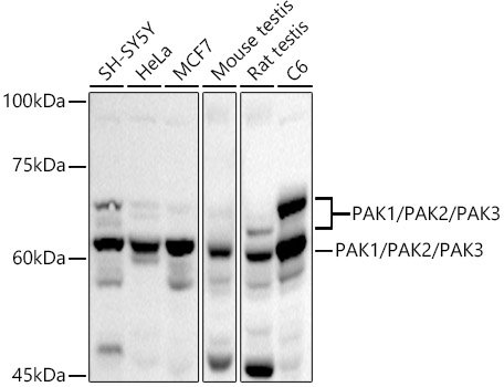 PAK1/PAK2/PAK3 Rabbit pAb