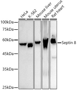 Septin 8 Rabbit mAb
