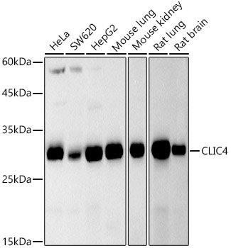 CLIC4 Rabbit mAb