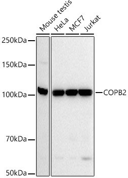 COPB2 Rabbit mAb