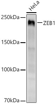 ZEB1 Rabbit mAb