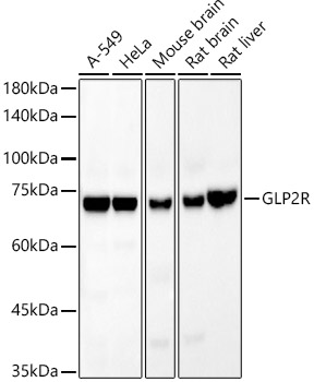GLP2R Rabbit mAb