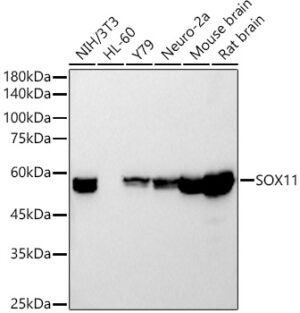 SOX11 Rabbit mAb