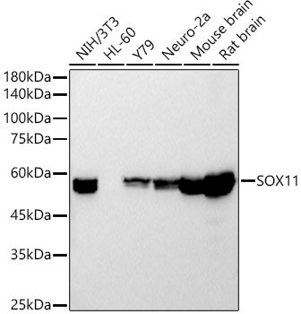 SOX11 Rabbit mAb