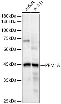 PPM1A Rabbit mAb
