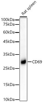 CD69 Rabbit mAb