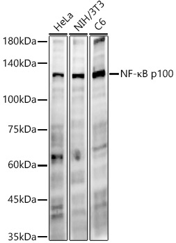 NF-κB2 Rabbit mAb