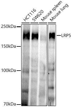 LRP5 Rabbit mAb