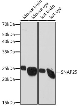 SNAP25 Rabbit mAb
